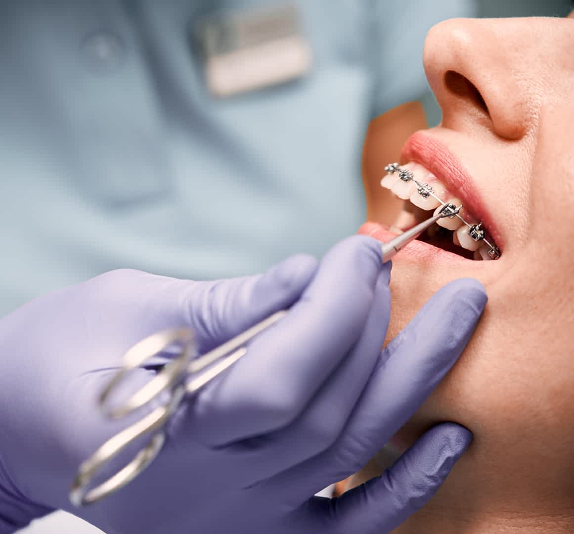 Orthodontists Kingston