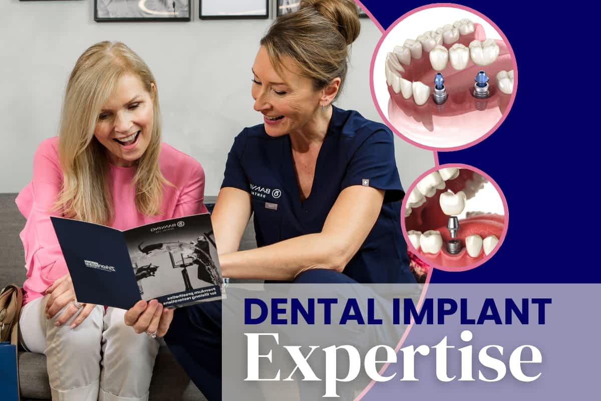 Dental Implants Expertise