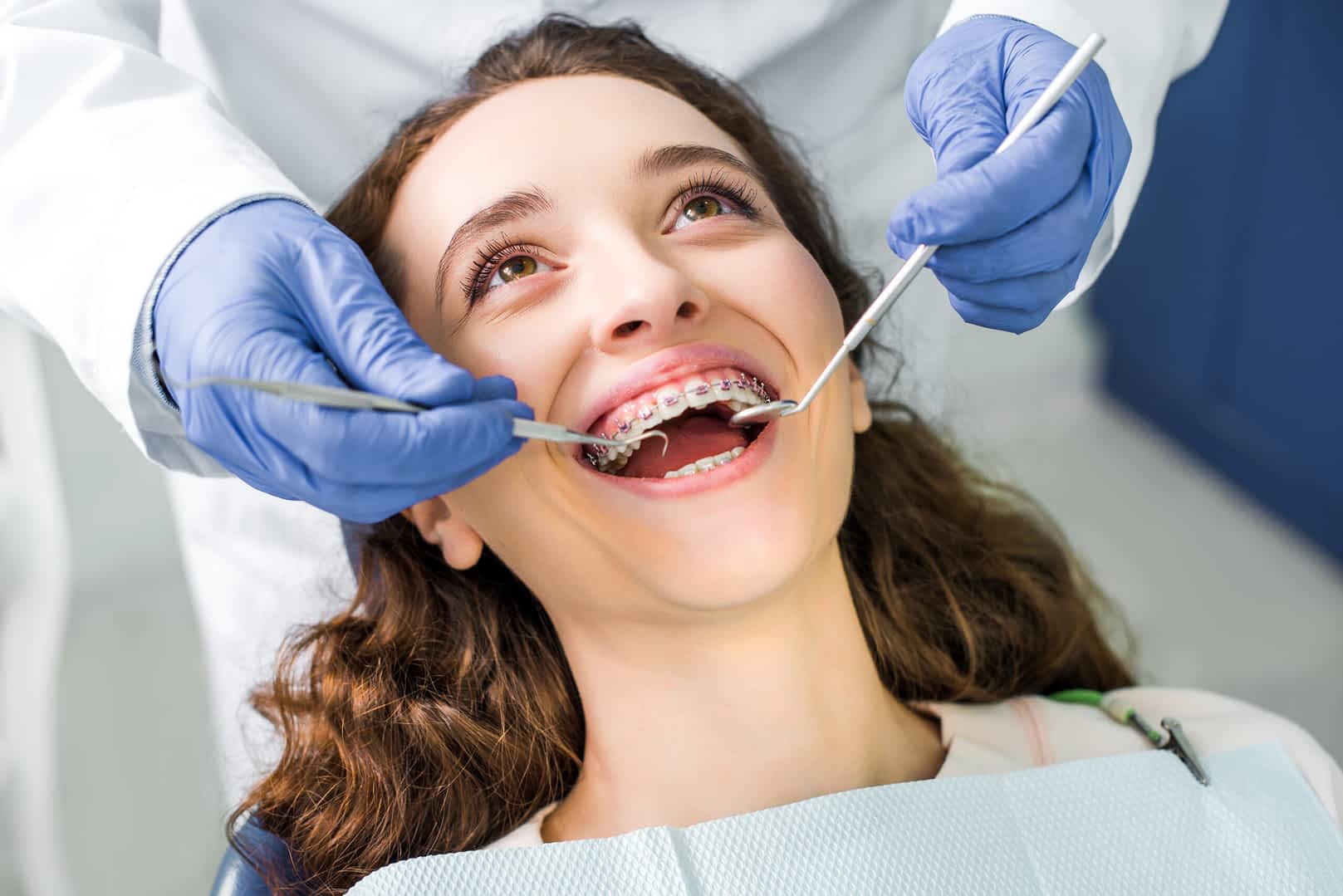 teeth-straightening- croydon