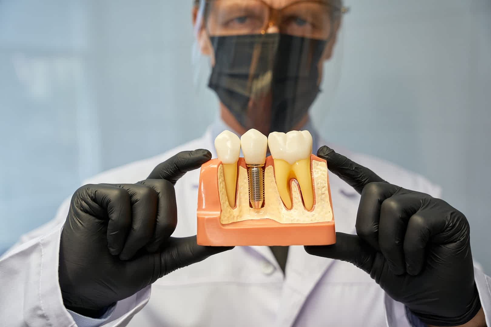 london-dental-implant