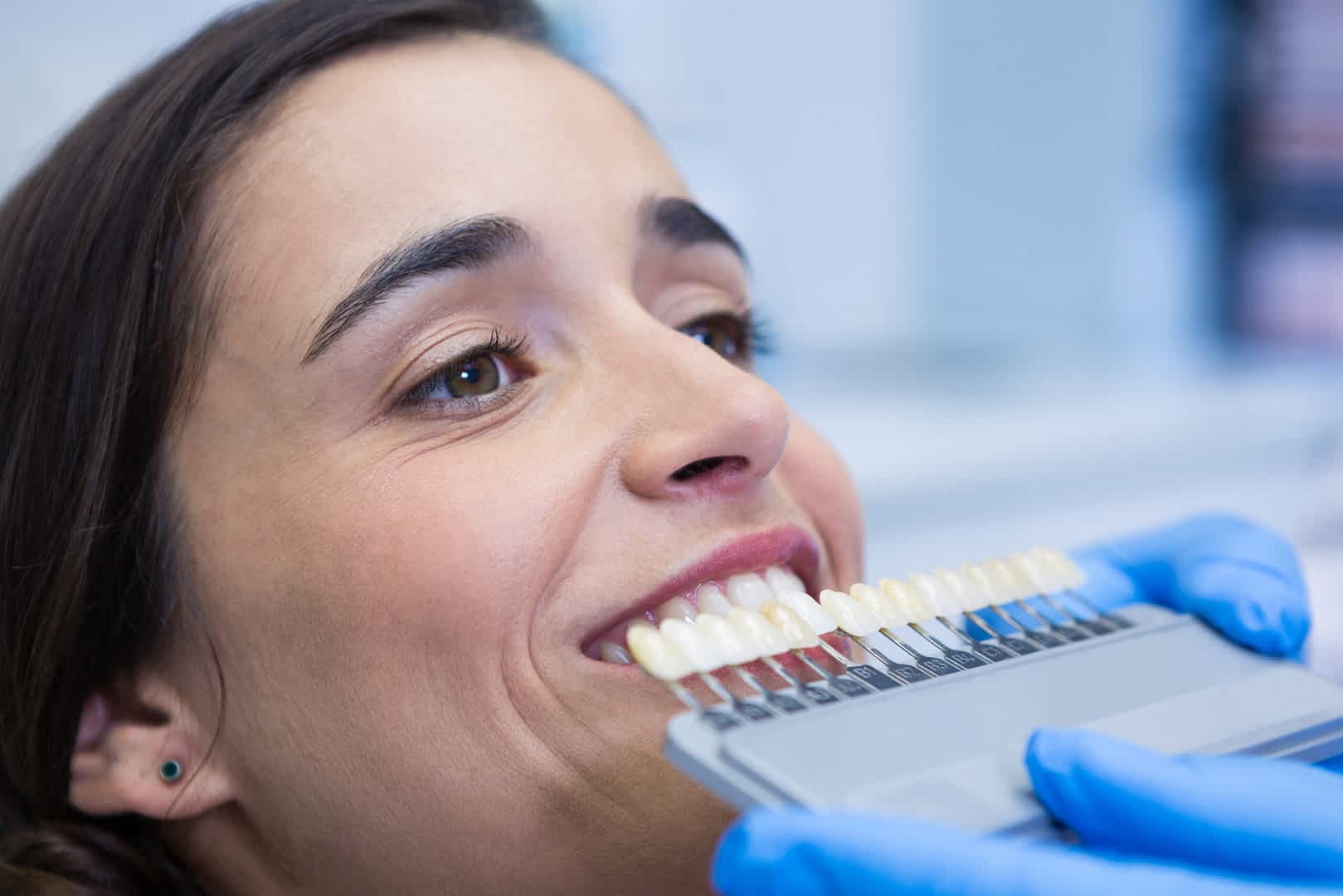 Composite Bonding: The Fastest Way to Transform Your Smile in One Visit
