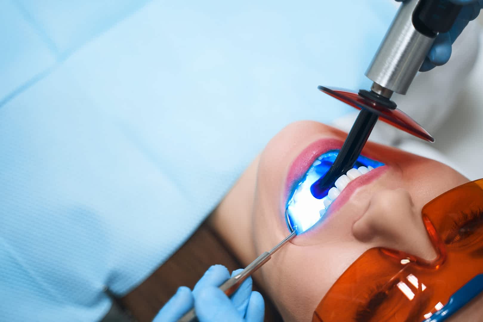 teeth-whitening-croydon