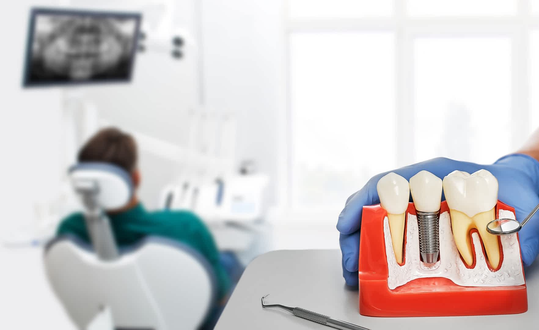 dental-implants-in- Croydon