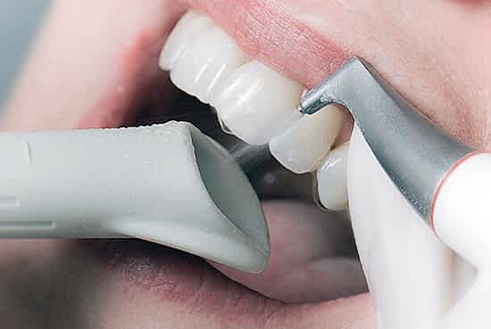 teeth cleaning