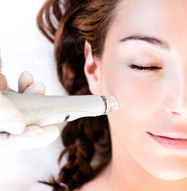 hydrafacial good for acne