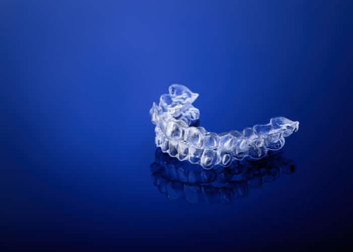 At home aligners