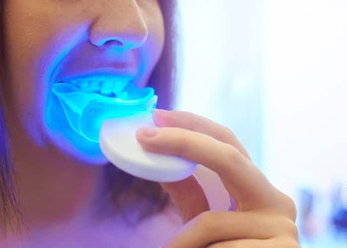 DIY Teeth Whitening