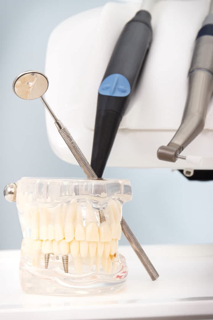 dental-implants-in-london