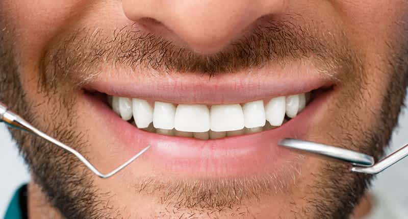 Smile Makeover: Transform Your Confidence with Cosmetic Dentistry 1 smile-makeover