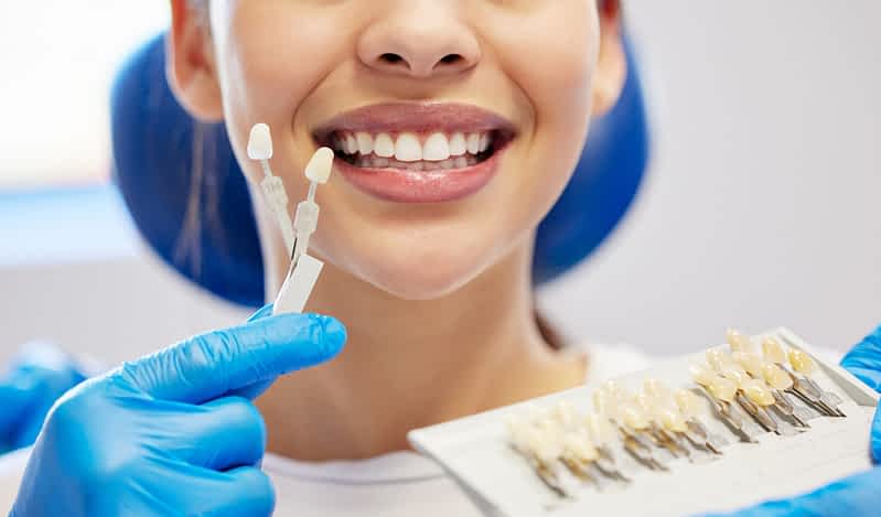 cosmetic-teeth- whitening