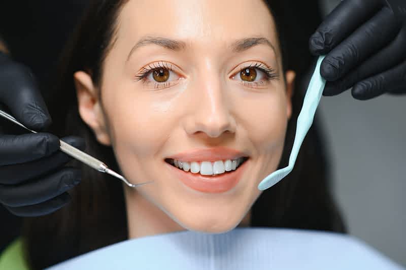 composite-veneers
