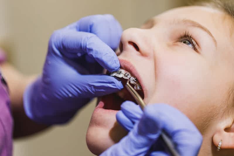 Choosing the Best Orthodontist for Children: A Path to a Radiant Smile 1 orthodontist-for-children