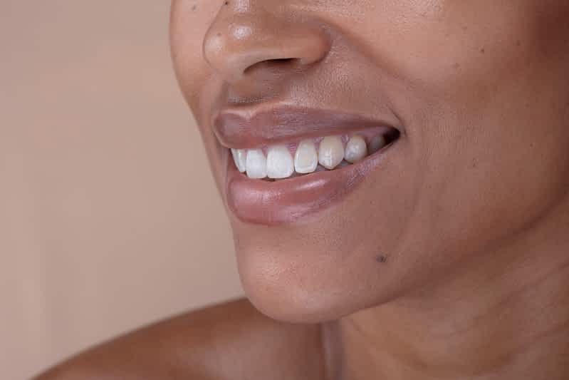 Smile Design: The Ultimate Guide to Transforming Your Smile with Cosmetic Dentistry 1 smile-design