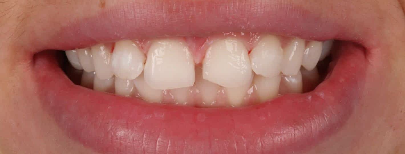 Before image alt