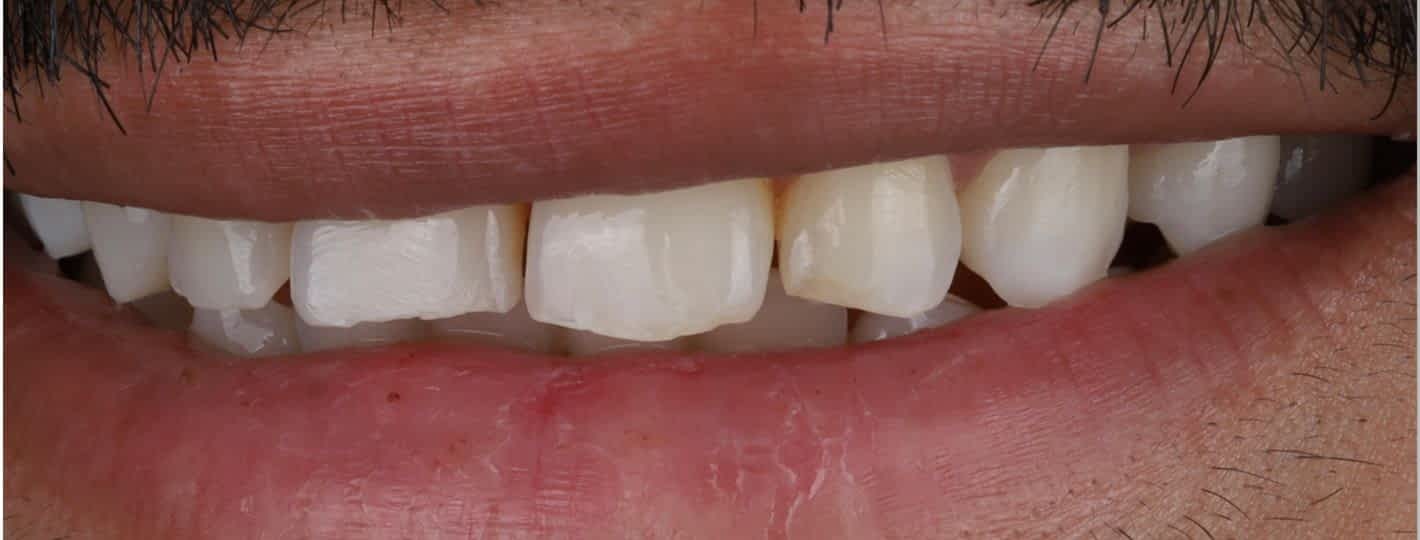 Before image alt