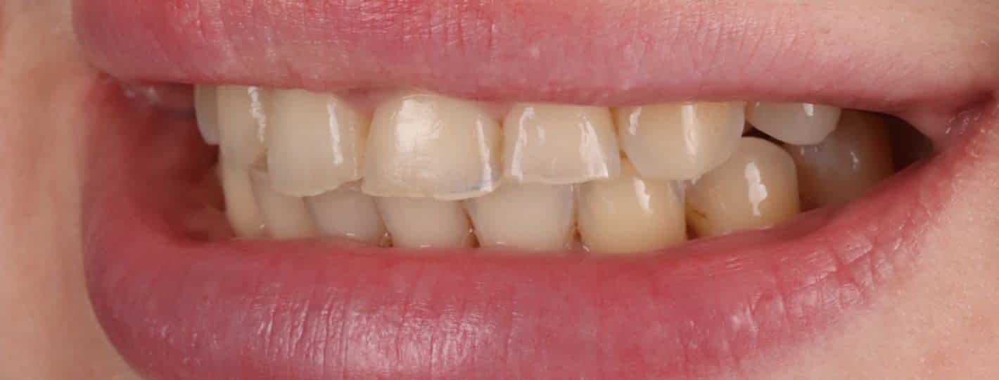 Before image alt